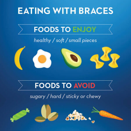 Foods eating-with-braces